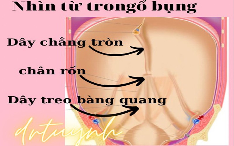 day-chang-tron