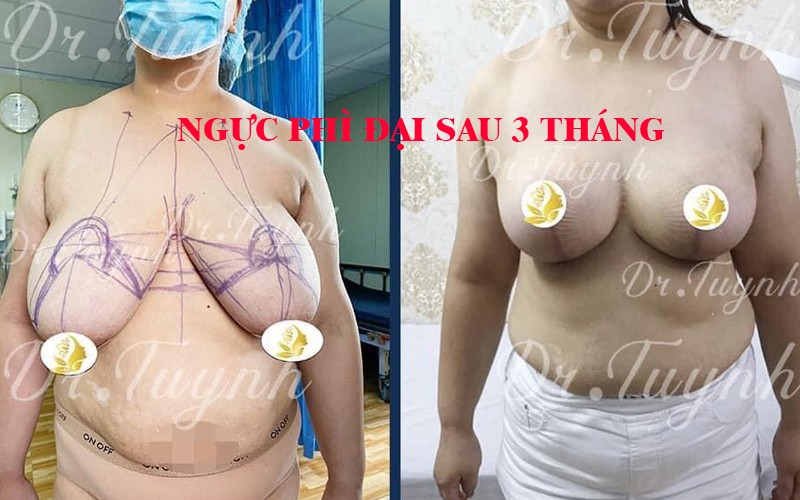 nguc-phi-dai-3-thang