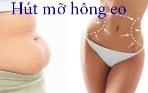 XÁC ĐỊNH VỊ TRÍ HÚT MỠ VÙNG HÔNG EO