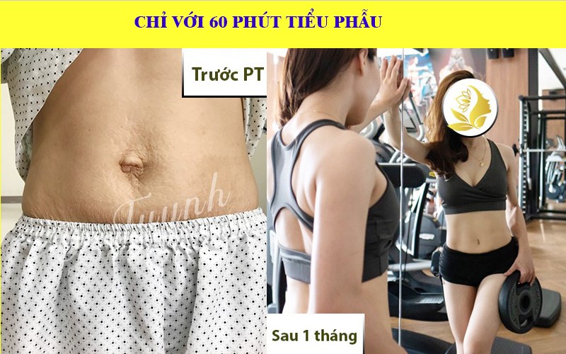 bai-tin-lam-dep-ron-cho-gymer