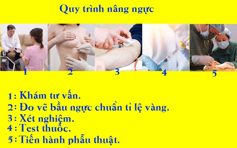 quy-trinh-nang-nguc