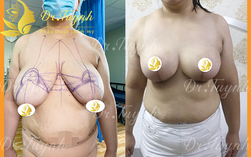 linh-hd