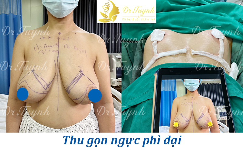 nguc-phi-dai-bac-si-tuynh