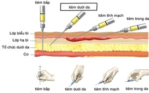 TIÊM VÀ CÁC CHÚ Ý CHUNG TRONG QUÁ TRÌNH TIÊM
