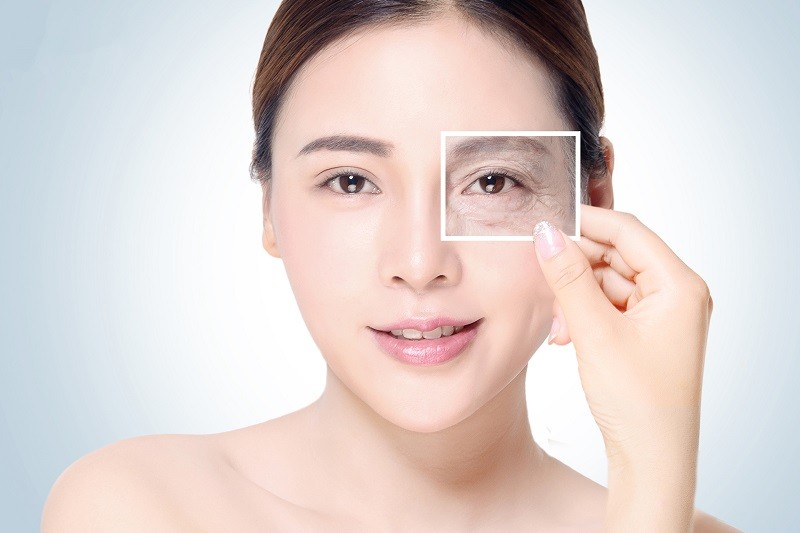 Nâng cung mày bằng tiêm botox có được không?