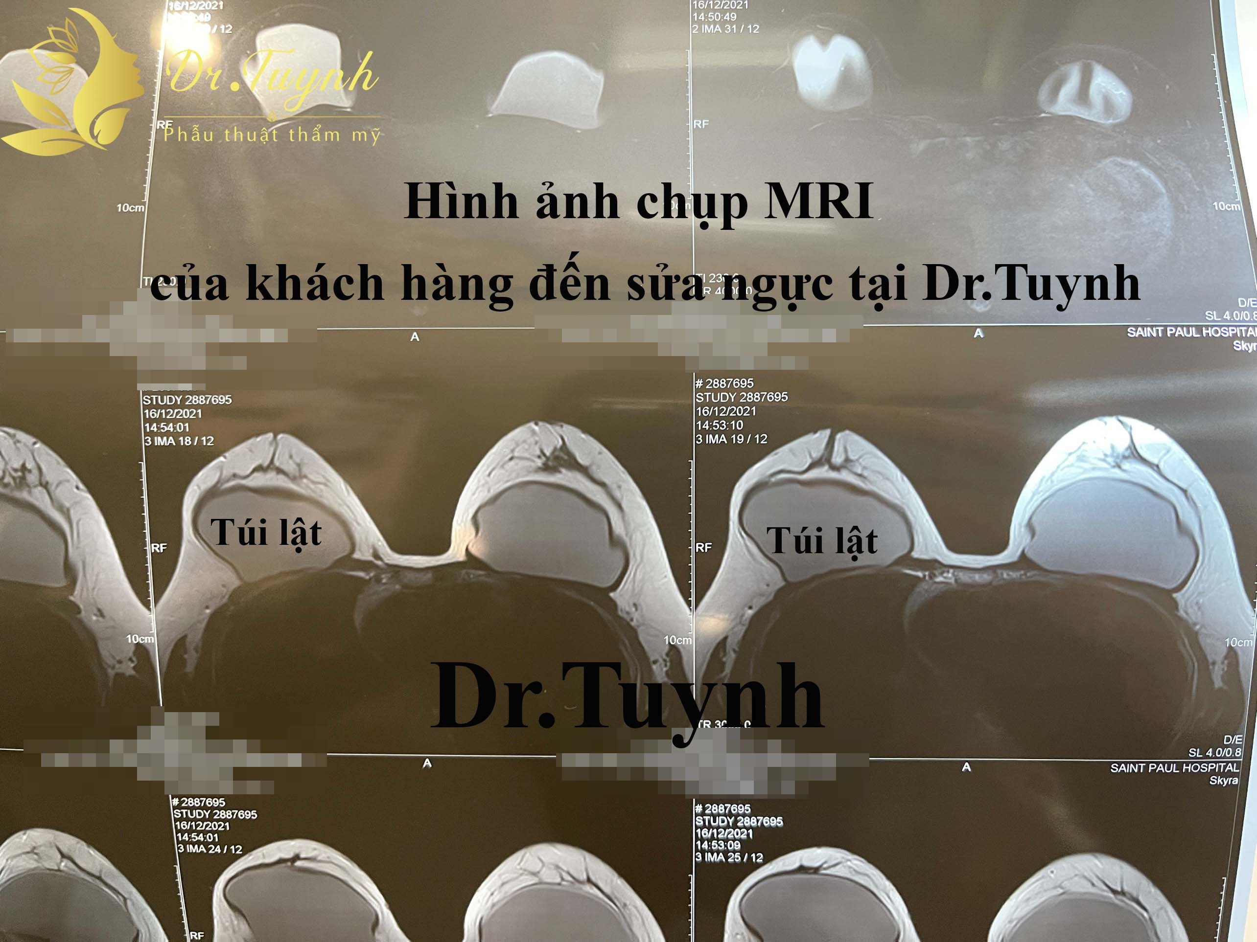 mri