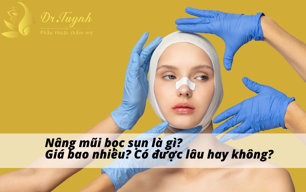Nâng mũi bọc sụn là gì? Giá bao nhiêu? Có được lâu hay không