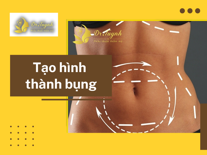 Lưu ý cần thiết để phẫu thuật tạo hình thành bụng an toàn