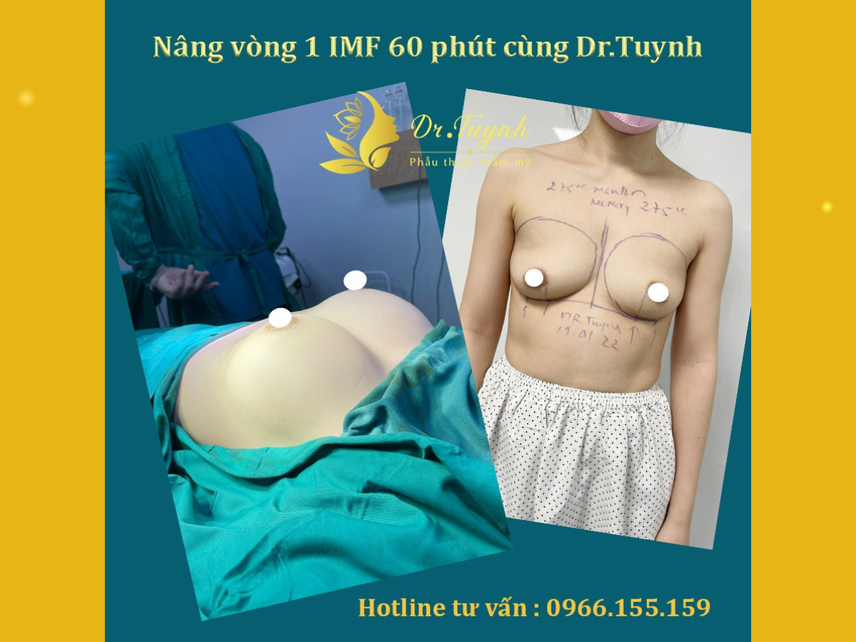 20-tuoi-vong-1-con-phat-trien-khong-6