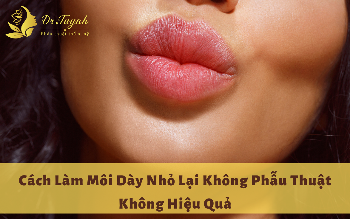 Cách làm môi dày nhỏ lại không phẫu thuật không hiệu quả