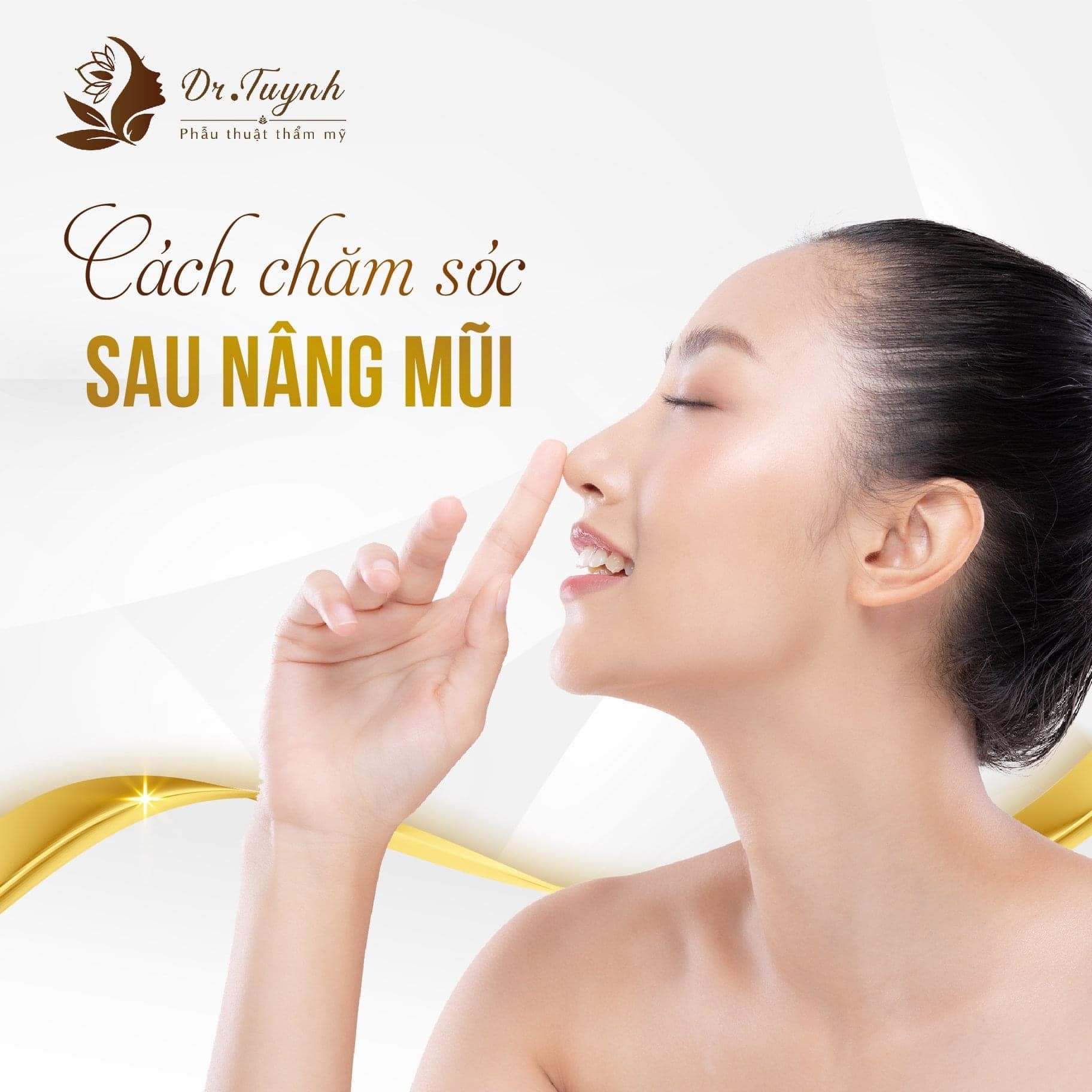 Nâng mũi chất liệu bán sinh học (Surgiform)