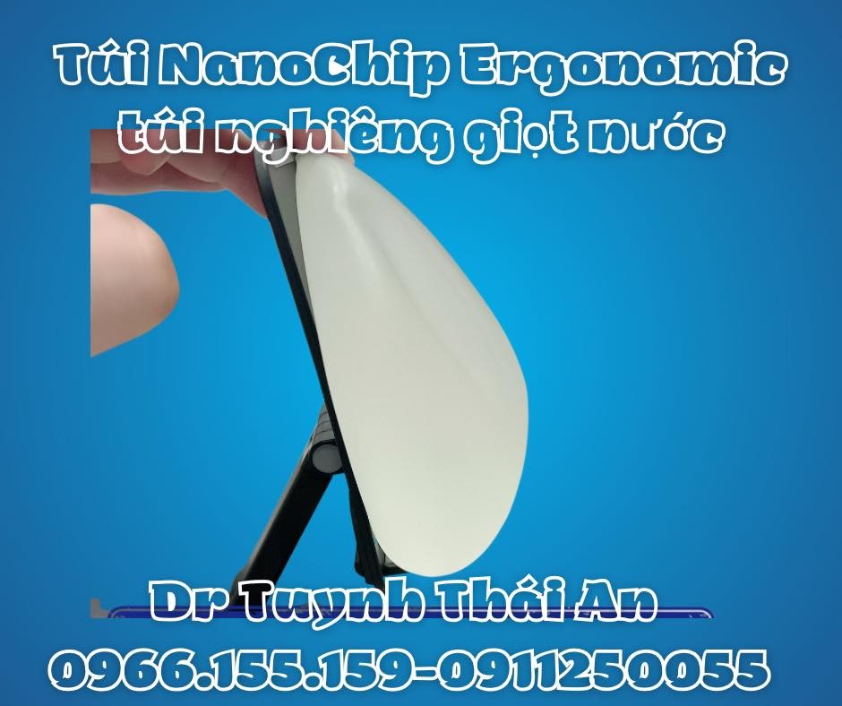 Thay túi độn ngực (bài chia sẻ của Bác sĩ Tuynh)