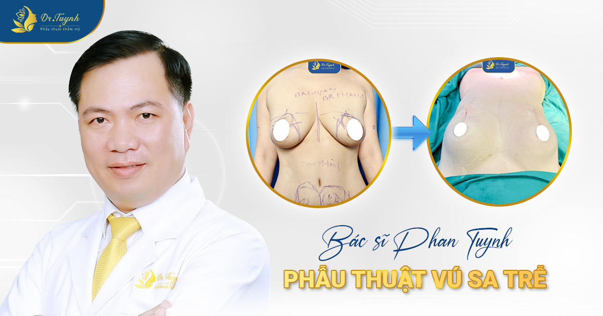 vu-sa-tre-1