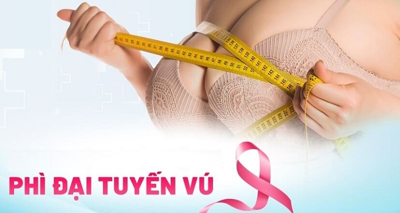 Chi phí phẫu thuật phì đại tuyến vú có đắt không?