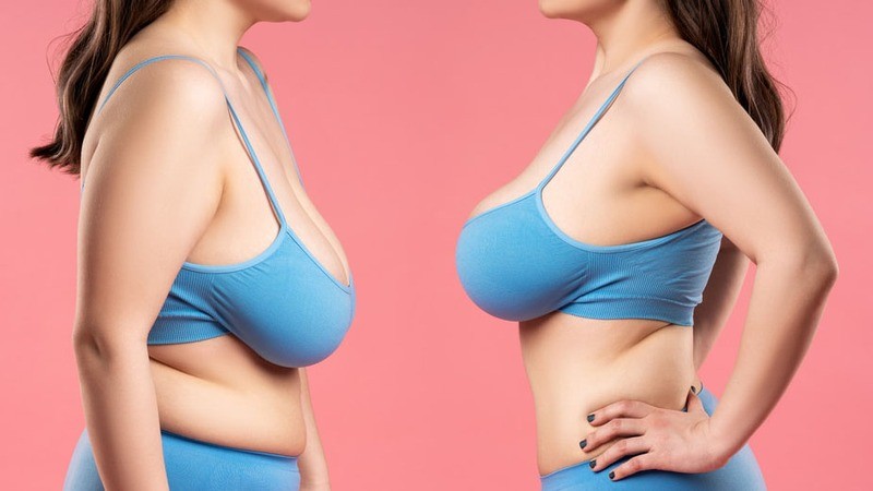 Nguyên nhân, cách khắc phục và cải thiện vòng 1 chảy xệ