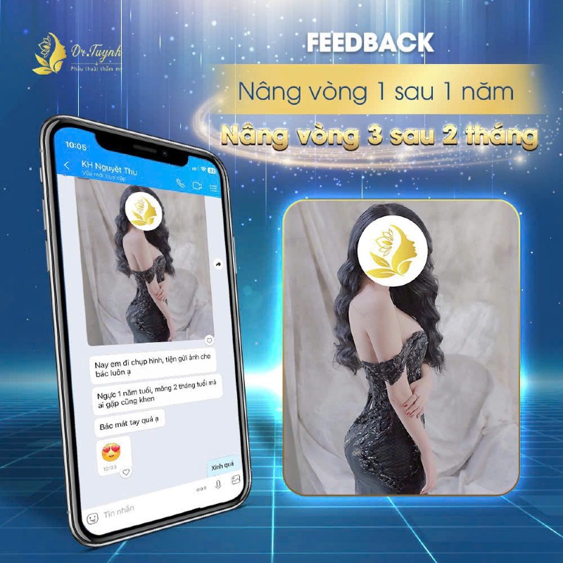 Cấy Mỡ Ngực
