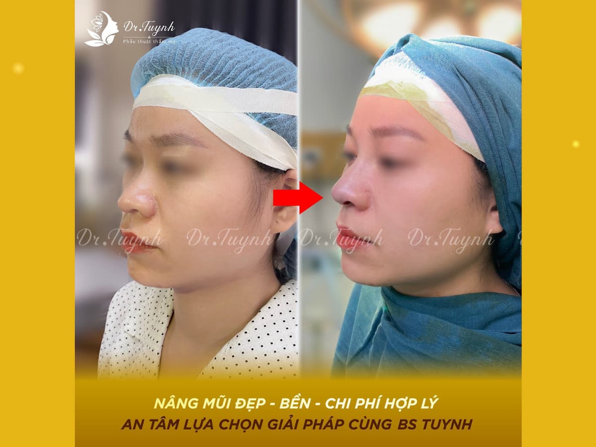 an-tam-lua-chon-dr-tuynh