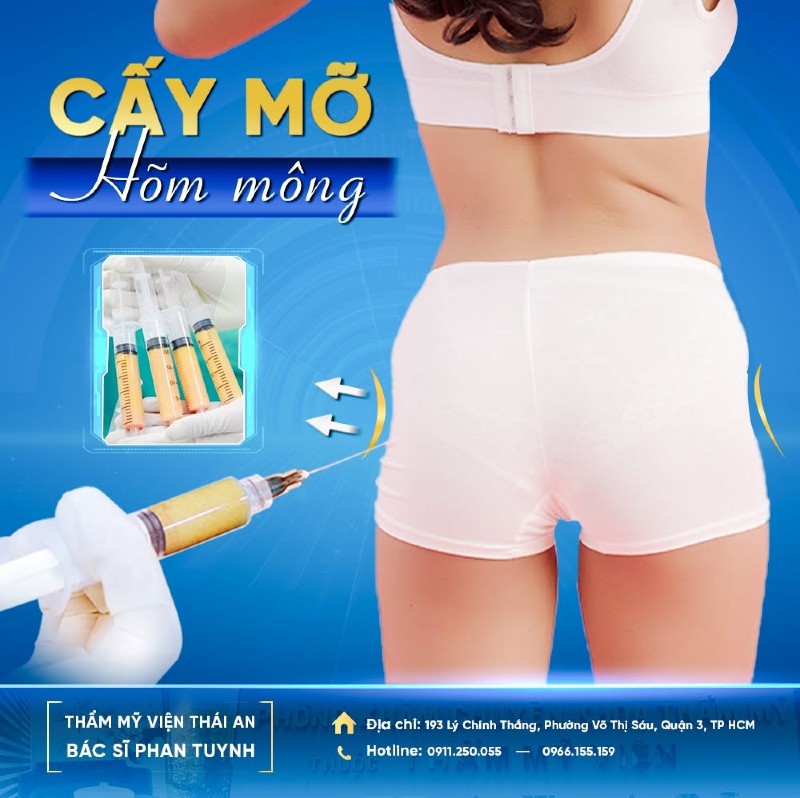 cấy mỡ mông c