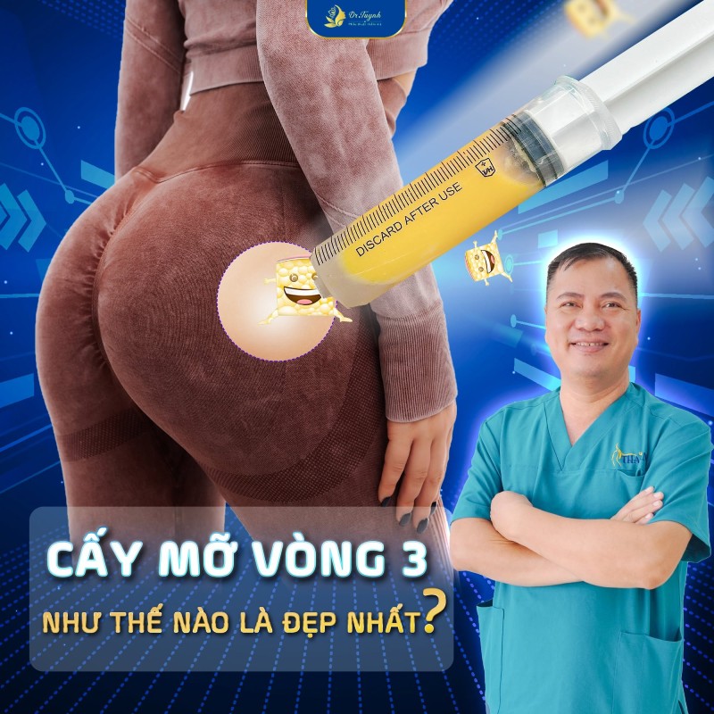 cấy mỡ mông