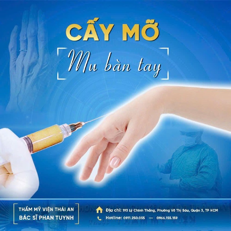 cấy mỡ mu bàn tay c