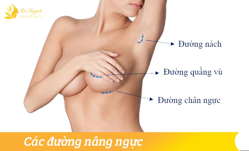 cac-duong-nang-nguc-noi-soi-1