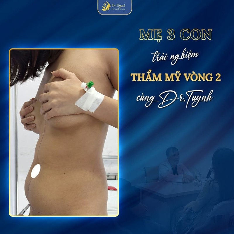 chăm sóc sau tạo hình thành bụng (1)