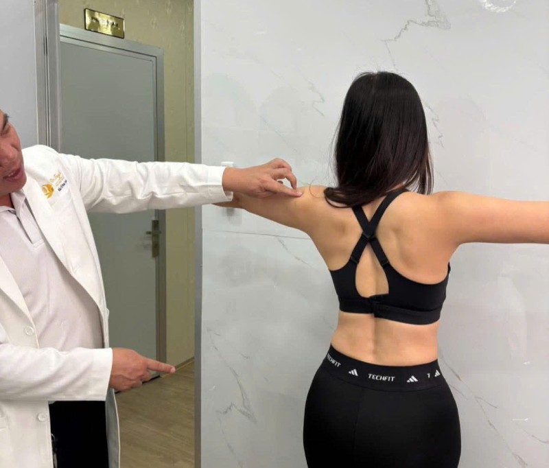 hút mỡ lưng vai