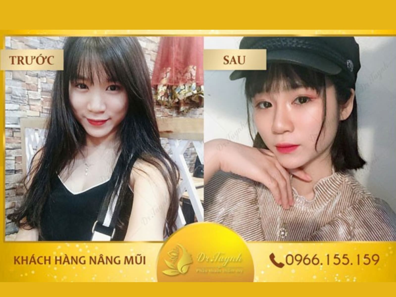 khach-hang-nang-mui-truoc-va-sau