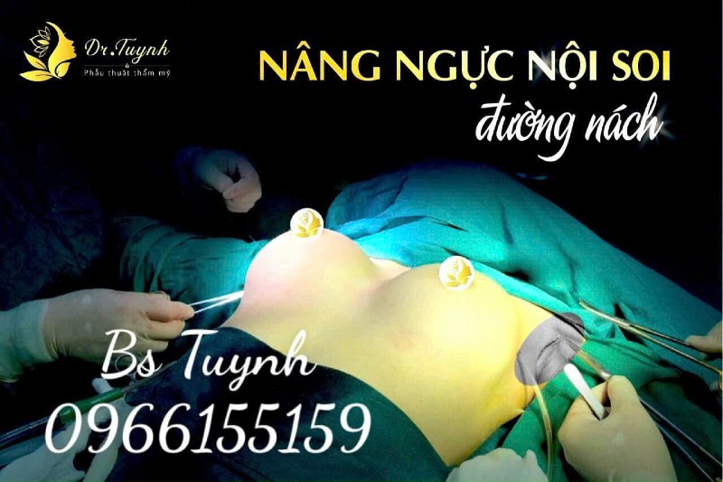 nâng ngực nội soi 1 2