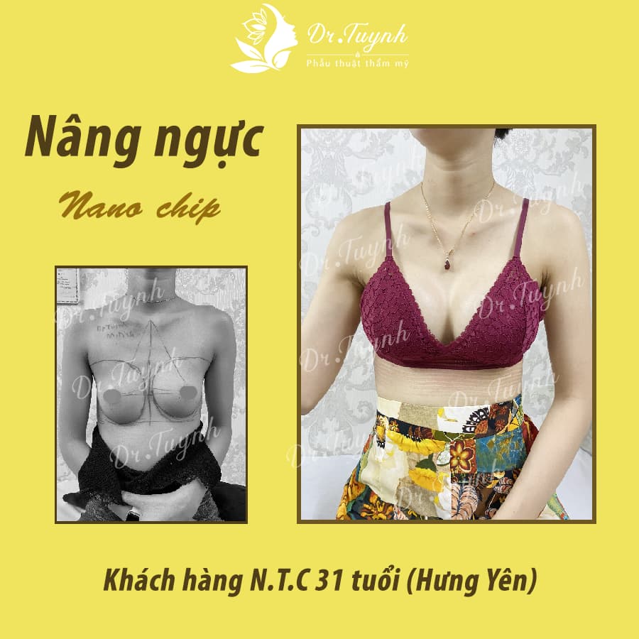 nang-nguc-noi-soi-2