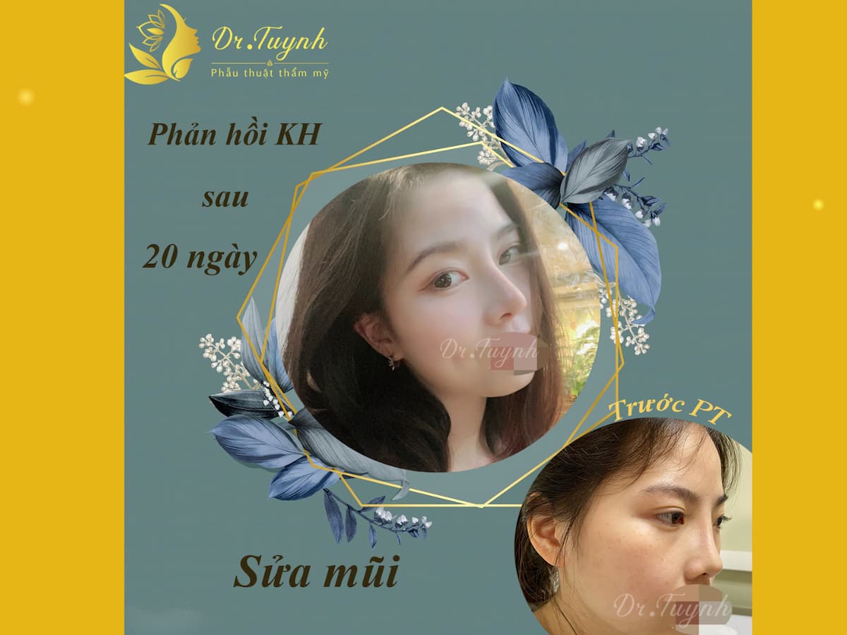 phan-hoi-cua-khach-hang