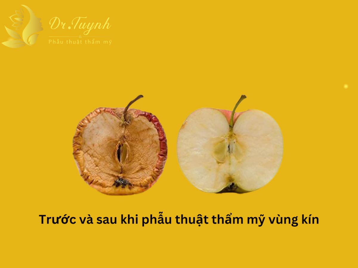 tham-my-vung-kin-cai-thien-cuoc-song