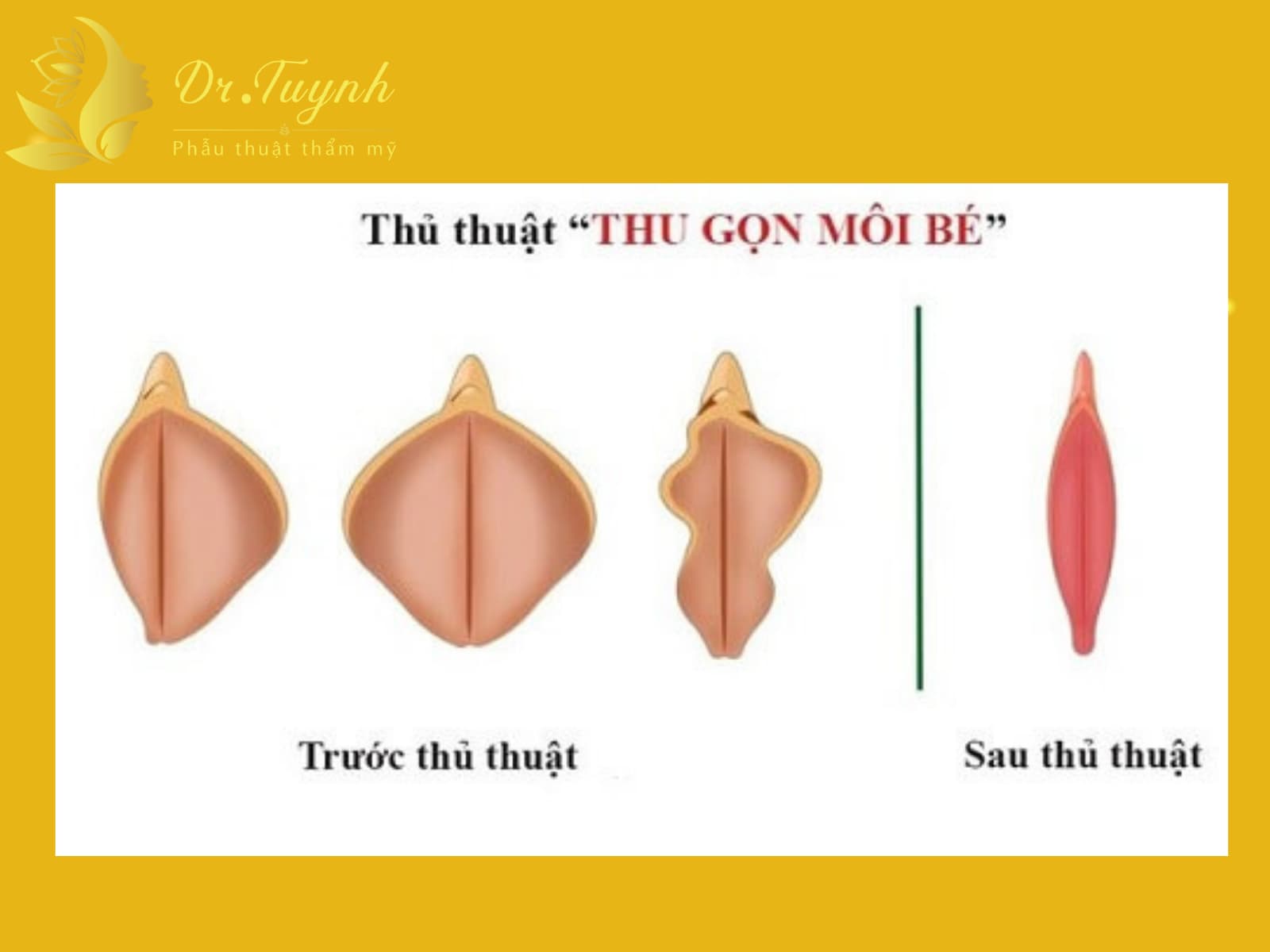 thu-nho-moi-be-khong-dau-don