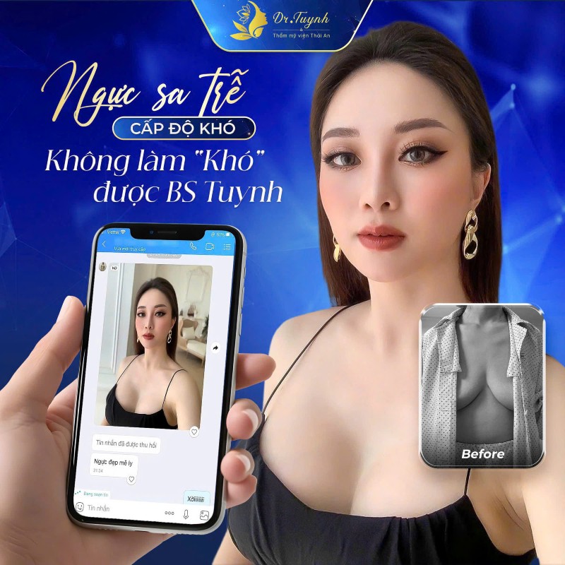 treo nguc sa tre 3