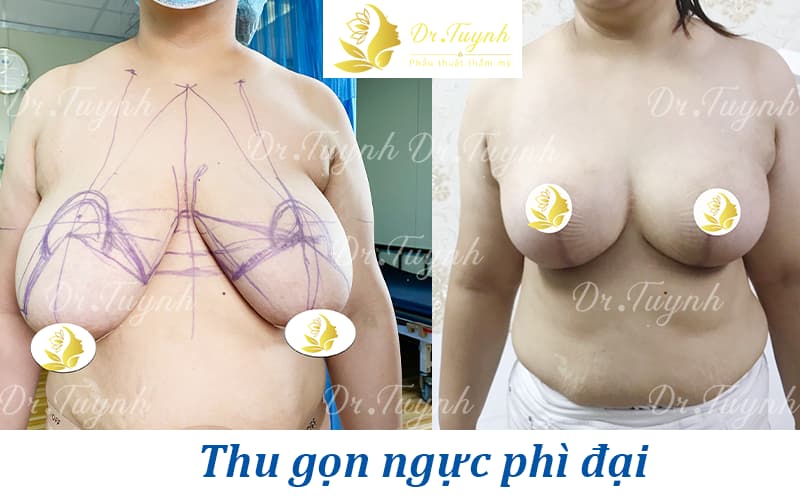 tuynh-sa-tre-web