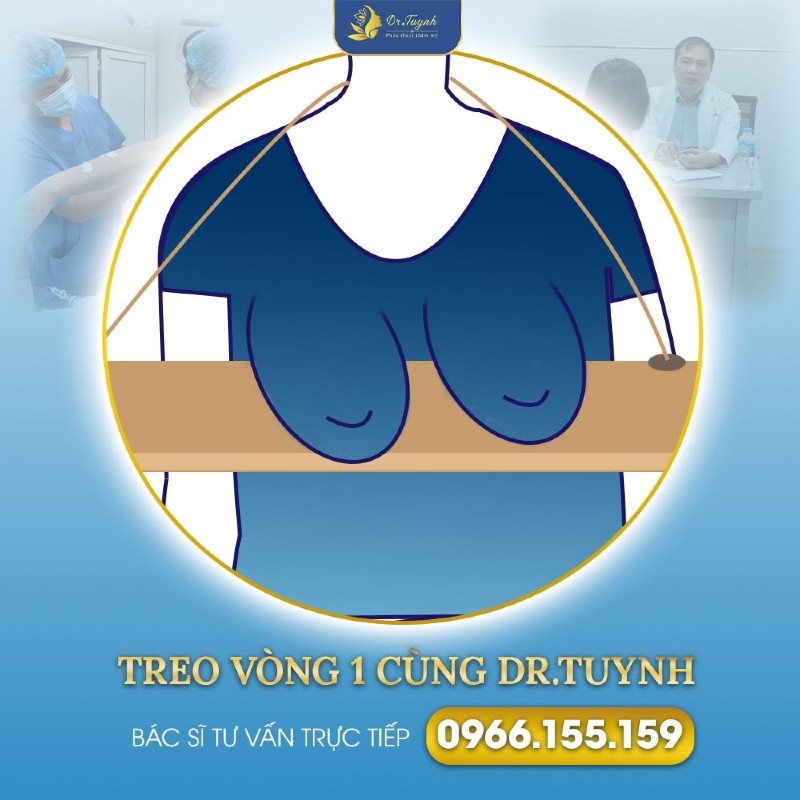 Hướng dẫn chăm sóc sau treo ngực sa trễ 1