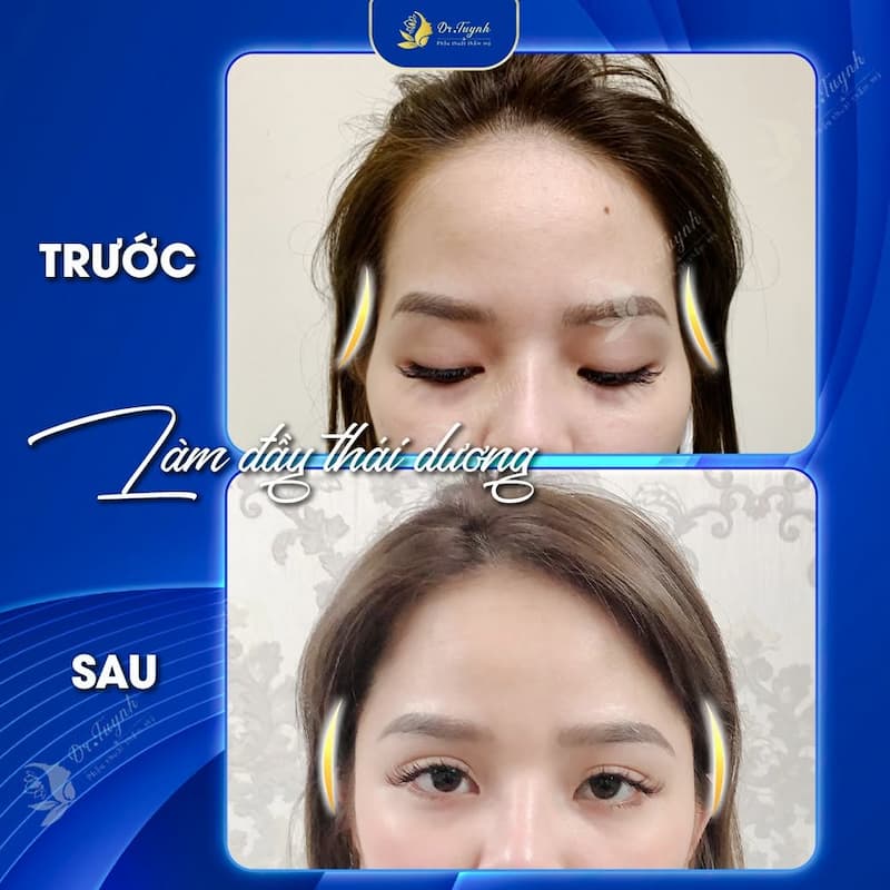 lam day thai duong (2)