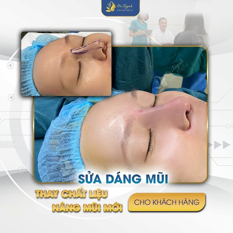 nang mui SUGIFORM (1)