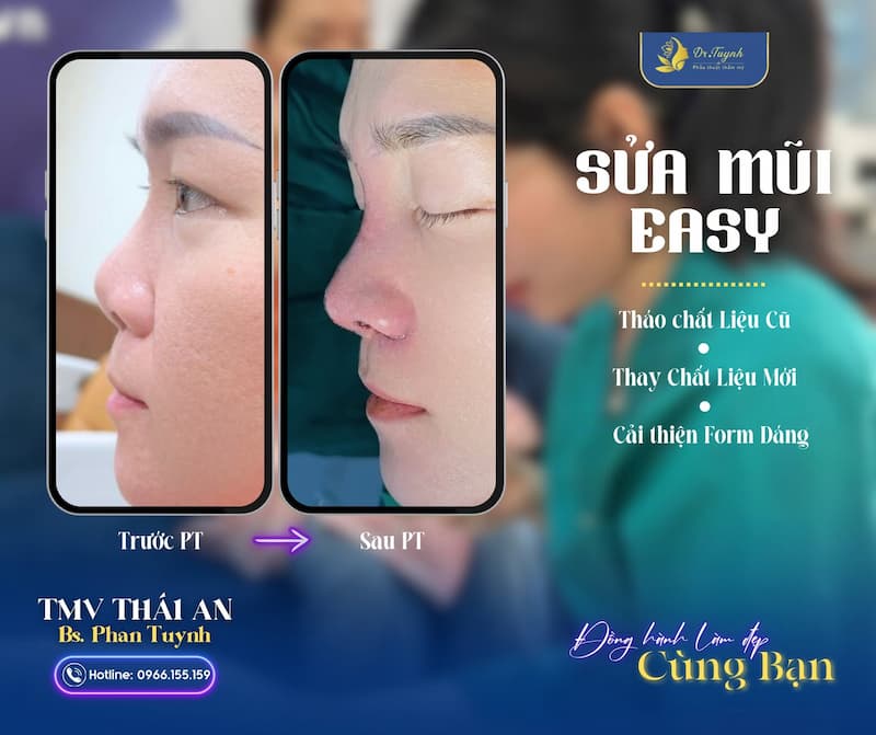 sua mui hong cho khach (1)