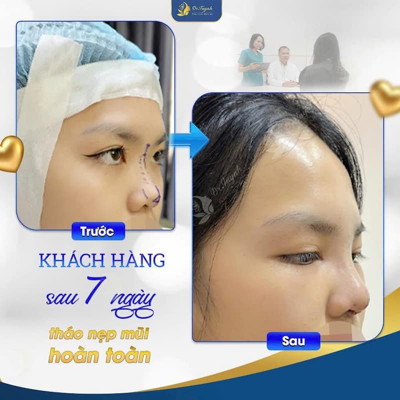 tham my mui dr tuynh (1)