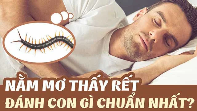 mo-thay-ret-danh-con-gi-2