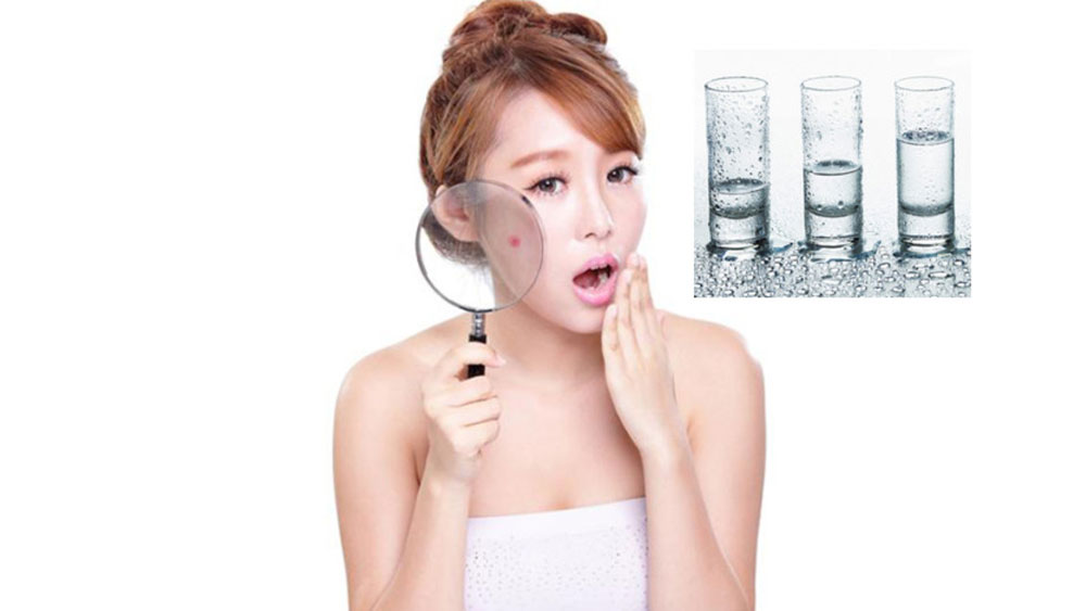 [Giải đáp] 1 ngày uống bao nhiêu nước để giảm mụn hiệu quả?