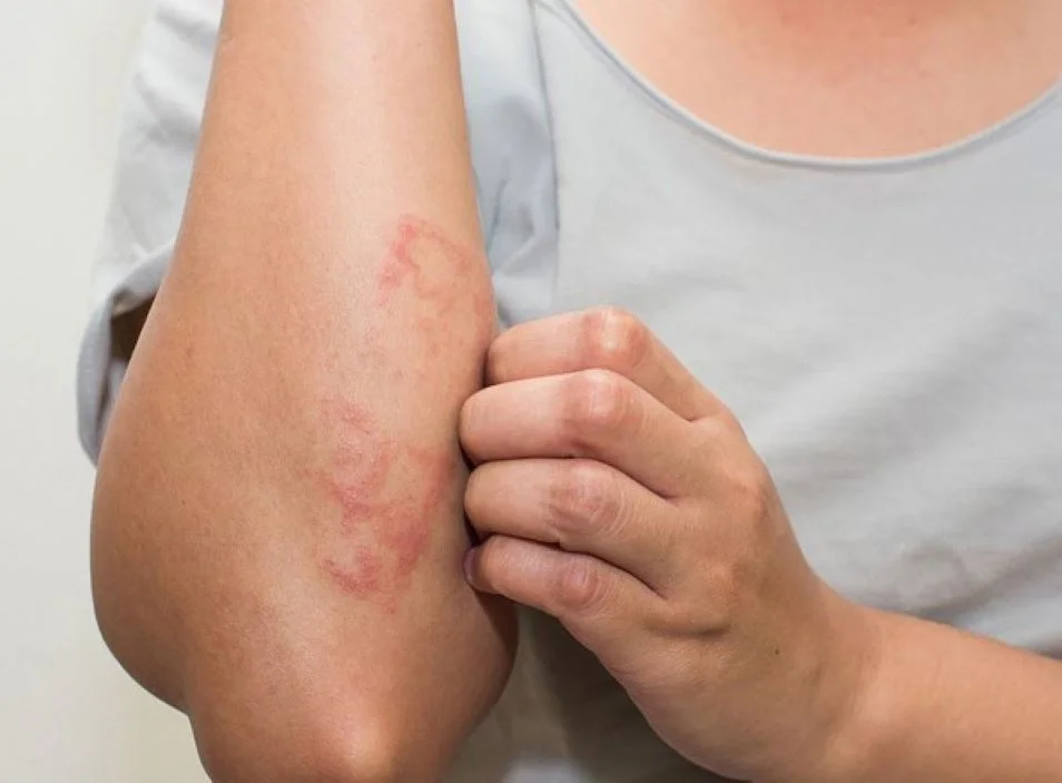 Chuyên gia giải đáp: 3+ Nguyên nhân uống nước kiềm bị ngứa