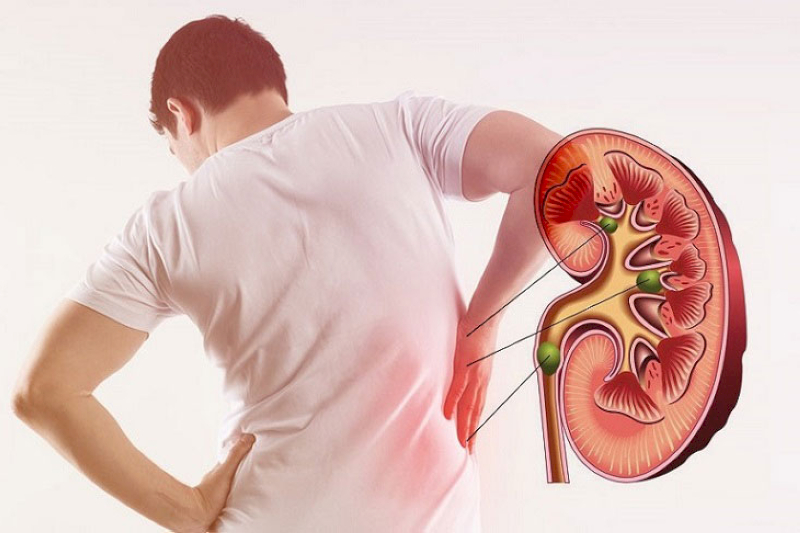 Những người có bệnh lý về thận không nên sử dụng nước ion kiềm
