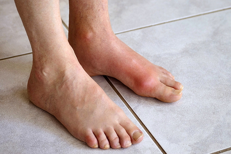 Using alkaline ionized water properly can reduce pain and swelling.