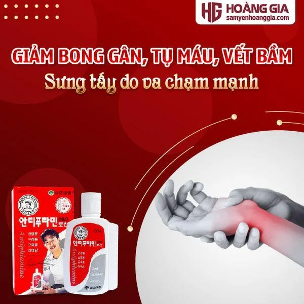dau_nong_xoa_bop_han_quoc_antiphlamine_100ml_giam_nhuc_khop-02_c257e4341cab44aa9b6743dc6259ff9d_grande