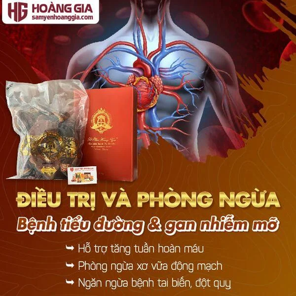 nam_lim_xanh_rung_le_phuc_hoang_gia_golden_class_hop_400gr-02_02d242e5a9b74fe2ae95ba248e3f0700_grande