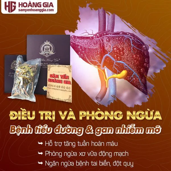 nam_lim_xanh_rung_tu_nhien_silver_class_thai_lat_hop_425gr-02_2ce9fc2e6bdb450c8a101c8db63ea2ae_grande