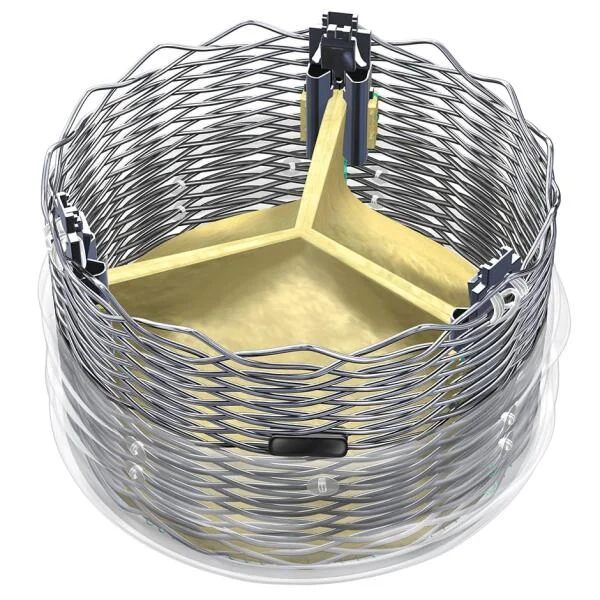 Mvalve