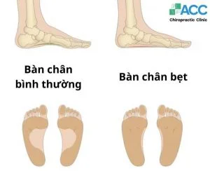 Hãy liên hệ với chúng tôi để tìm hiểu thêm về các loại Chân